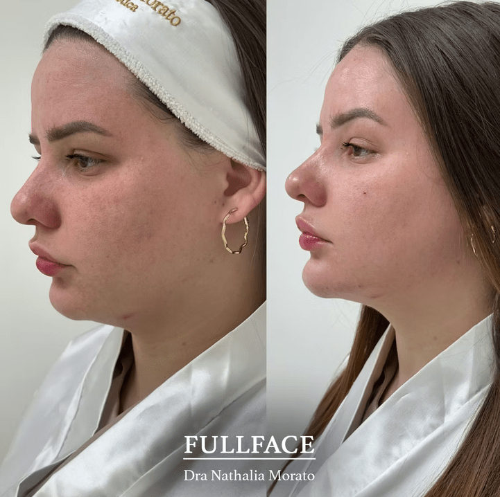 imagem_2025-06-30_171410857