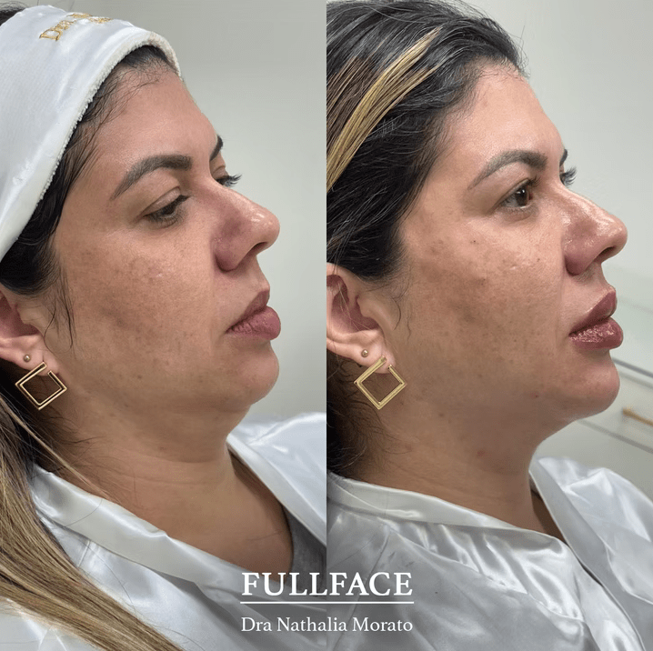 imagem_2025-06-30_171952521