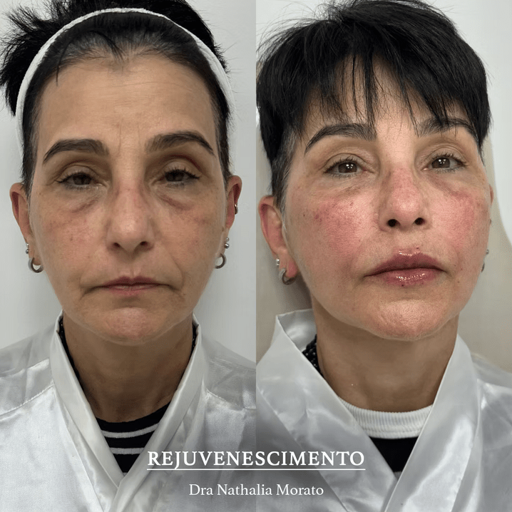 imagem_2025-06-30_172105300