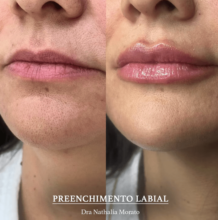 imagem_2025-06-30_172140757