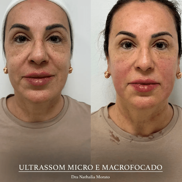 imagem_2025-07-18_112137046